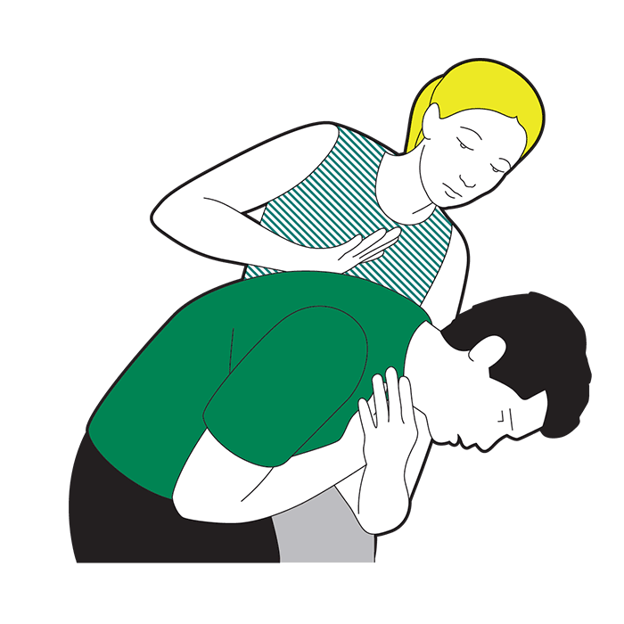 Adult choking first aid - give them five sharp back blows between their shoulder blades