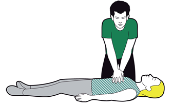 Adult CPR - repeat compressions 30 times; at a rate of 100-120 compressions per minute