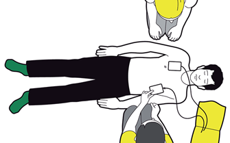 Using a defibrillator - attach pads