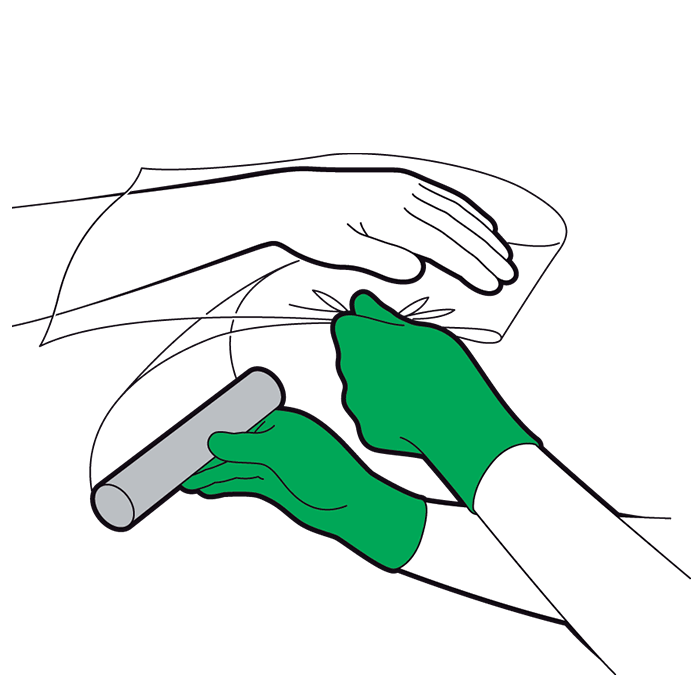 Adult minor burns and scalds - cover area loosely with cling film