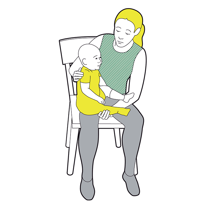 Baby minor burns and scalds - monitor the baby