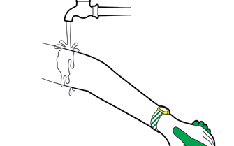 Burns and scalds - children - start cooling the burn or scalds as quickly as possible