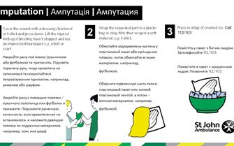 Amputation